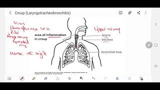 Croup cough baby [upl. by Ahseela]