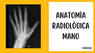 Anatomía Radiológica  Radiología Convencional Mano  Proyección posteroanterior y lateral [upl. by Immat]