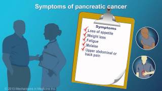 Pancreatic Cancer Signs Symptoms and Risk Factors [upl. by Letram185]