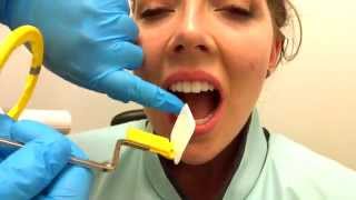 How to Take Periapical Radiographs [upl. by Eanom]