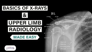 Radiological Anatomy Made Easy Basics of XRays and Upper Limb Radiology [upl. by Ahrens]