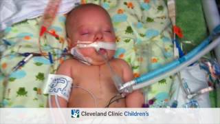 Congenital Heart Disease Tetralogy of Fallot Full Version [upl. by Rollo]