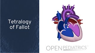 Tetralogy of Fallot with Pulmonary Regurgitation [upl. by Joost]