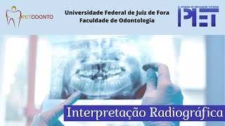 Interpretação Radiográfica Identificação de Estruturas [upl. by Innus160]