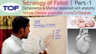 Fetal echocardiography at 1113 weeks Tetralogy of Fallot TOF [upl. by Brasca997]