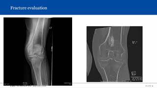 Introduction to Musculoskeletal Radiology [upl. by Ablem689]