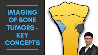 Imaging of Bone Tumors  Key Concepts  Dr Venkatesh Manchikanti ShadesofRadiology [upl. by Raybourne]