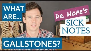 What are gallbladder stones [upl. by Vivle]