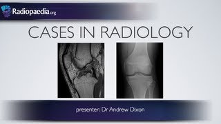 Cases in Radiology Episode 4 musculoskeletal MRI xray [upl. by Baniaz]